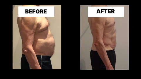 What Symptoms Can Diastasis Recti Cause in Men? Weak Core, Back Pain and Poor Posture Hassocks
